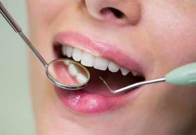 Oral-Cancer