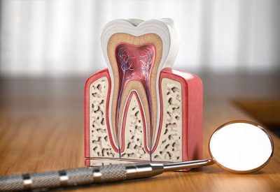 Root-Canal-Treatment