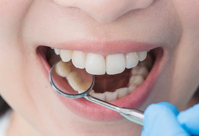 For wisdom tooth extraction, contact Dr. Beena George Dentistry - dental clinic in Mississauga.