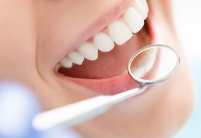 Book a consultation with Dr. Beena George Dentistry for oral cancer screening or any other dental issue.