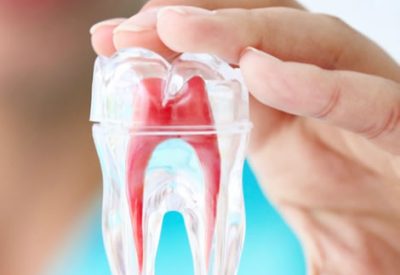 For your root canal treatment, contact Dr. Beena George Dentistry in Mississauga.
